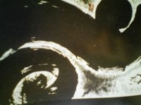 /album/%e3%83%95%e3%82%a9%e3%83%88%e3%82%ae%e3%83%a3%e3%83%a9%e3%83%aa%e3%83%bc/tomdeikitai-jpg/